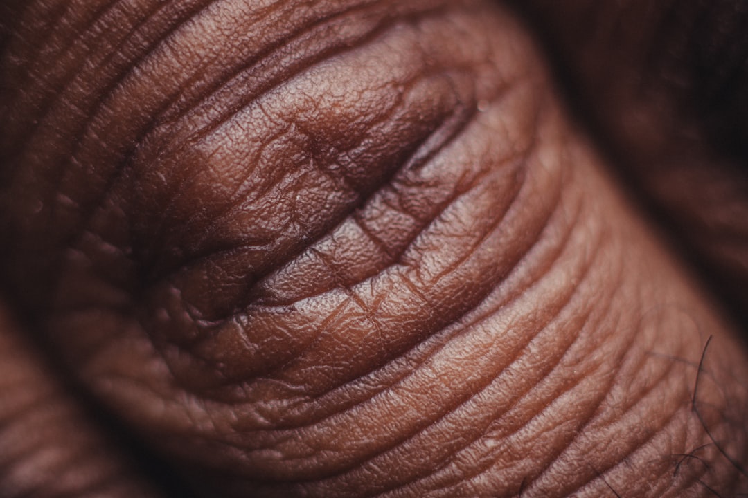 Photo Sensitive skin: Cream, Moisturizer